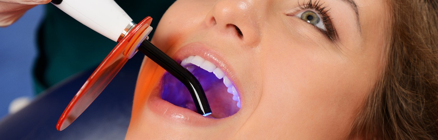 UV light applied to woman’s dental bonding