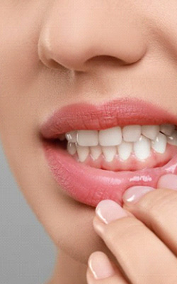 a person showing signs of gum disease