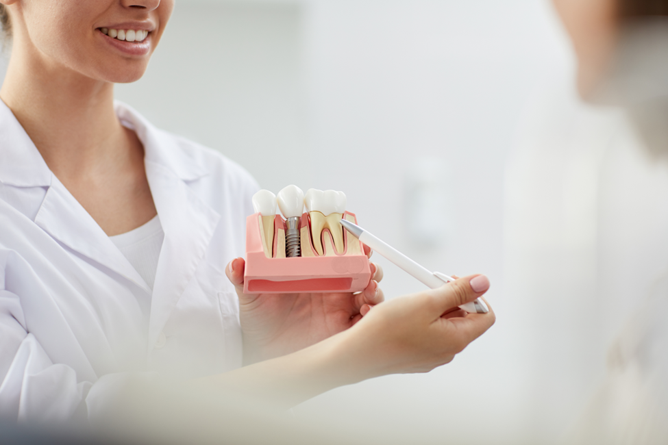 a close-up of a dental implant model.